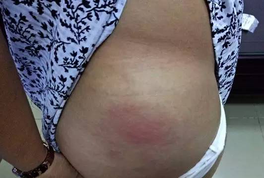 百名备孕女在海南某医院打黄体酮出问题;男子扮女生露下体丨新闻特搞-怀孕期