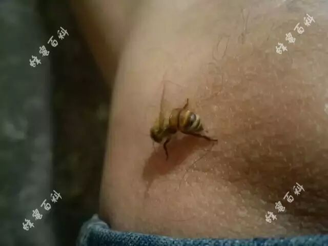 【健康话题】治疗关节炎最好的药—蜂毒