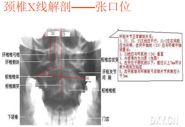 放射微课堂:颈椎x线诊断