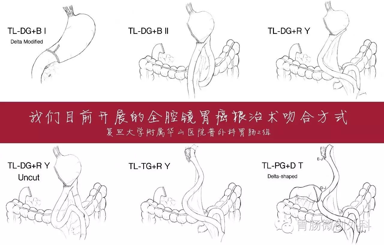 复旦大学附属华山医院,普外科胃肠专业2组随访平台