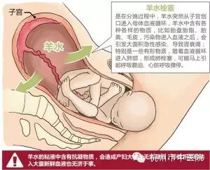 产妇突发羊水栓塞命悬一线 六小时全院多科协作击退“死神” 高龄、二胎产妇增多 要小心这种病-怀孕期