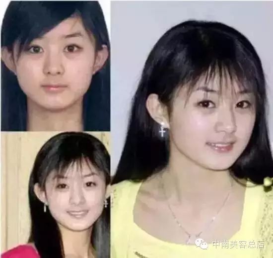 开扒赵丽颖 土包子整了哪?