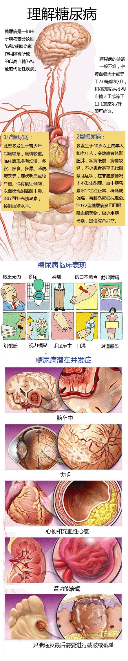 图解《理解糖尿病》
