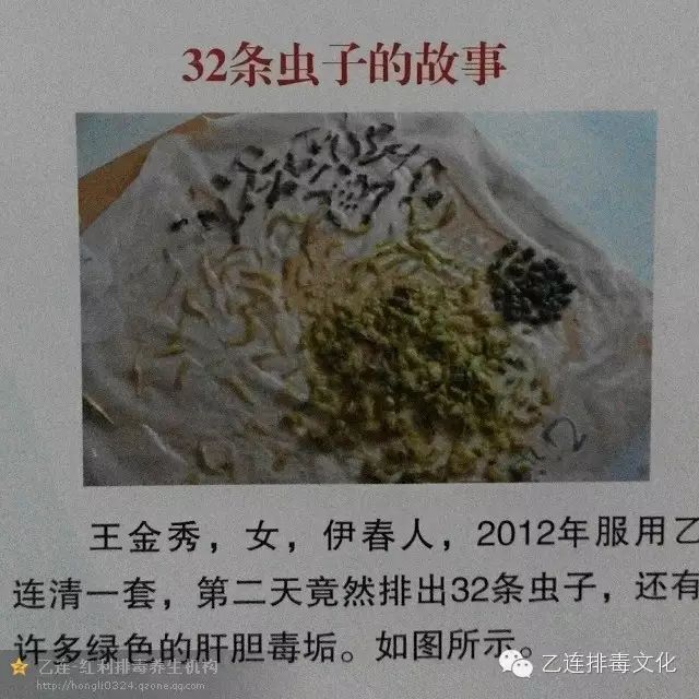 【排毒文化】乙连各种虫类,肿瘤-癌症患者特殊排毒案例