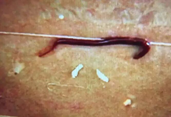 外卖里有红色“活物”!吃了几口“被怀孕”,店家的解释竟是……-怀孕期