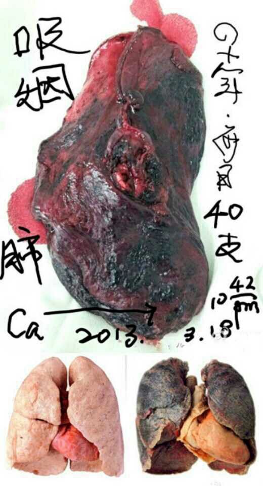 香烟真不是人抽的  香烟 健康 戒烟 微信 第2张