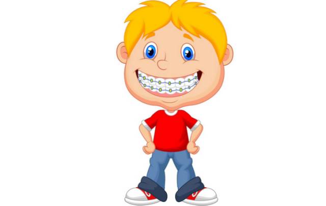 必备正畸小常识!高颜值不是问题！