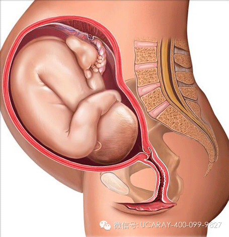 【超全胎位示意图】孕妇最担心胎儿姿势