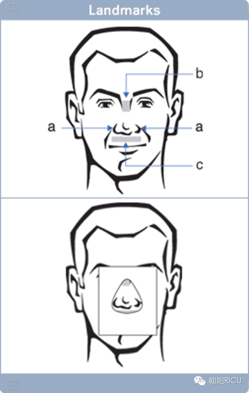 epap什么模式无创呼吸机（二）_https://www.jmylbn.com_新闻资讯_第69张