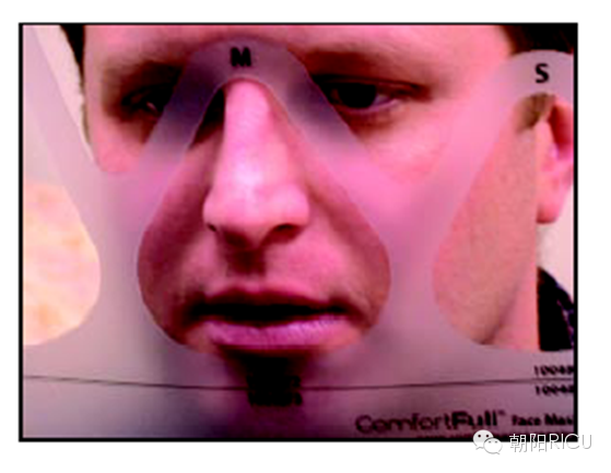 epap什么模式无创呼吸机（二）_https://www.jmylbn.com_新闻资讯_第71张