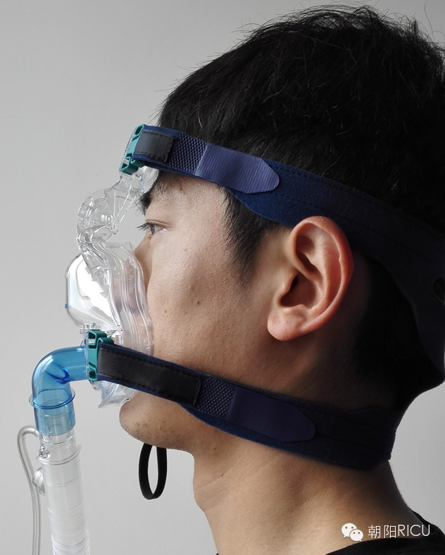 epap什么模式无创呼吸机（二）_https://www.jmylbn.com_新闻资讯_第74张