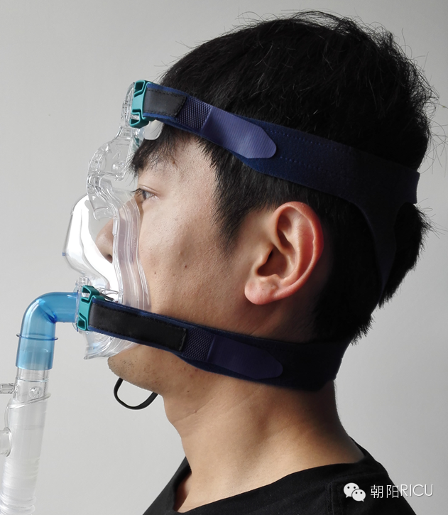 epap什么模式无创呼吸机（二）_https://www.jmylbn.com_新闻资讯_第73张