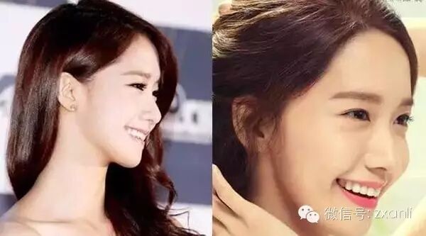 林允儿整容前居然像男人!