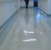 怀孕期间会骨折吗?-怀孕期