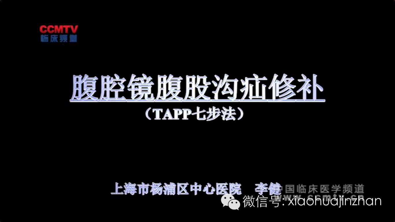 李健:腹腔镜腹股沟疝修补