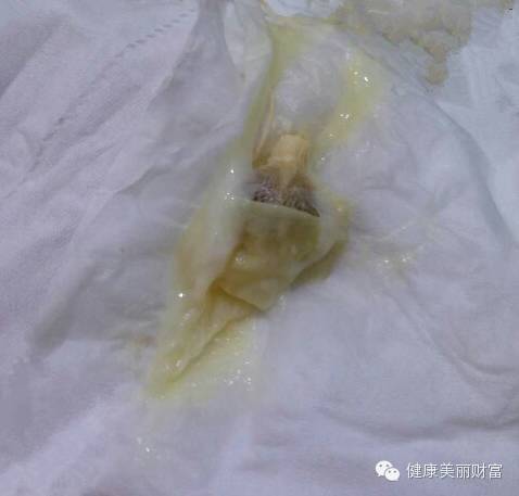 花清丹故事(2):怀孕了,这个孕怀得好辛苦……-怀孕期