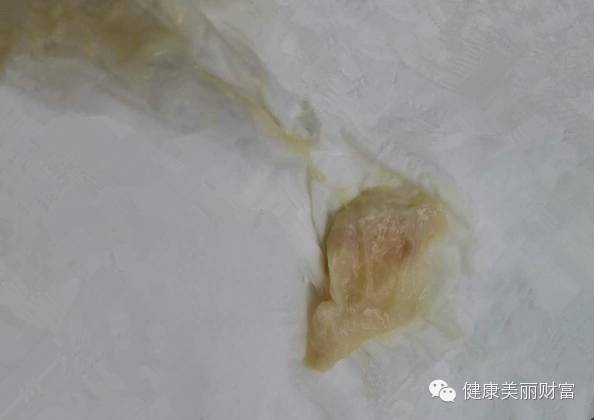 花清丹故事(2):怀孕了,这个孕怀得好辛苦……-怀孕期