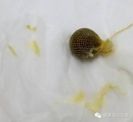 花清丹故事(2):怀孕了,这个孕怀得好辛苦……-怀孕期