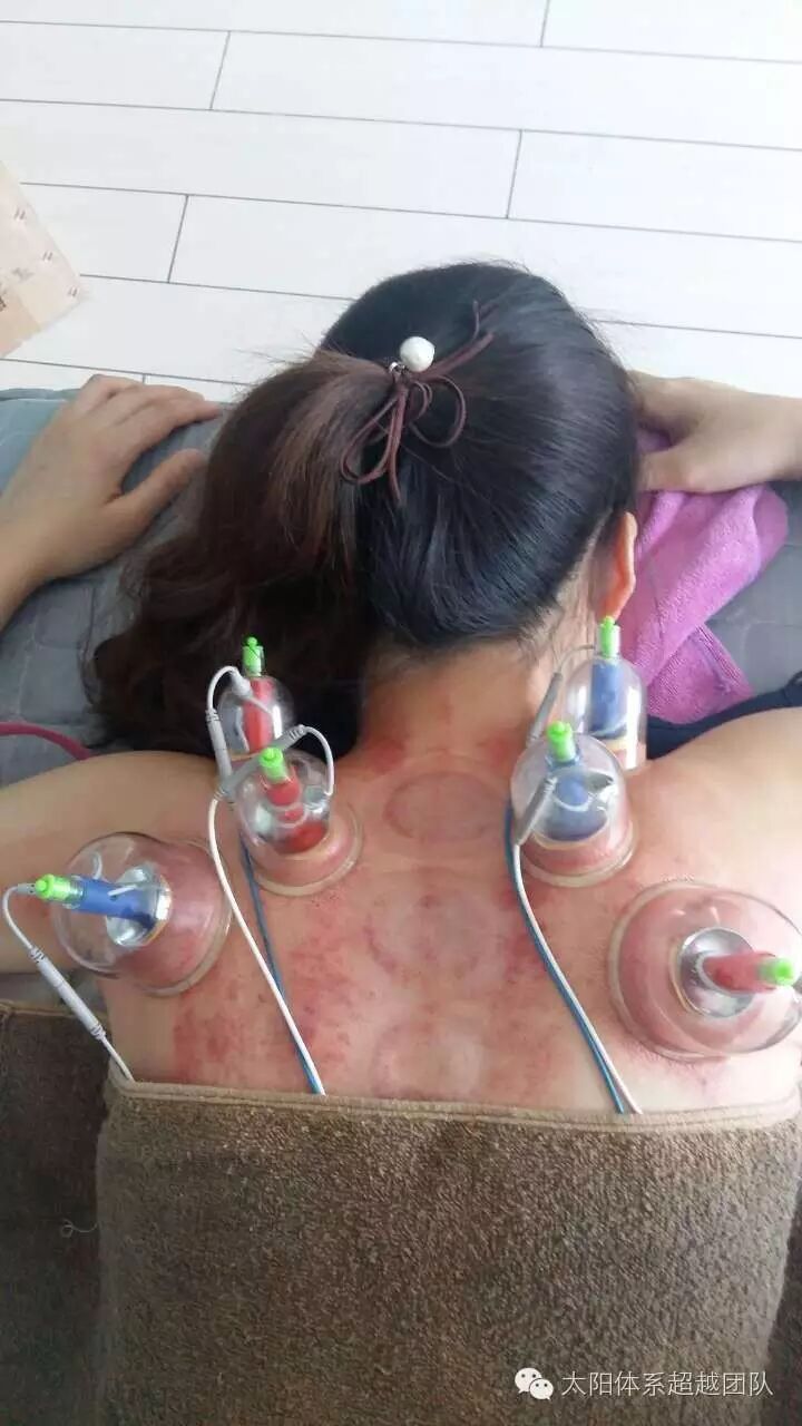 权健经络治疗仪以电疗,磁疗,针灸,拔罐等为手段,实现绿色非药物治疗和