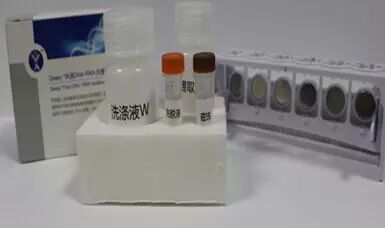 【速递】Qeasy核酸提取技术优化新方法(图2)