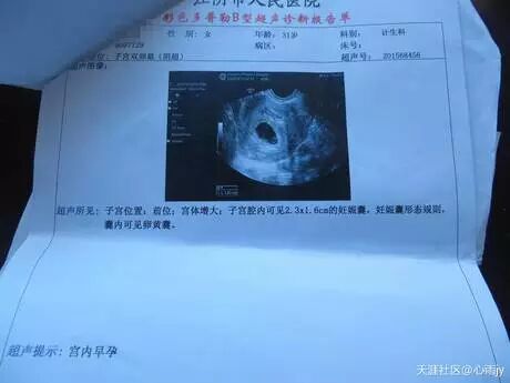 曝光江阴人民医院计划生育科赵纯燕人流不取胚胎-怀孕期