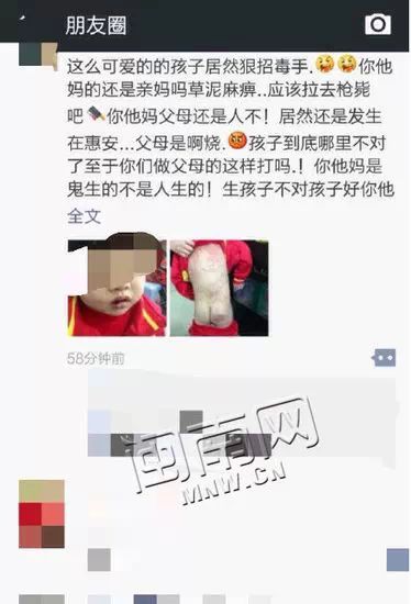 是親媽嗎？！ 泉州5歲女童遭母親衣架暴打  滿背皆是傷 戲劇 第4張