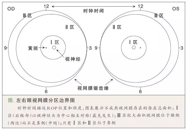 早产儿视网膜病变筛查指南