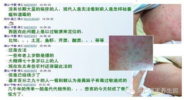 【春三月】除春瘟 <wbr> <wbr>蓖麻籽与大红萝卜樱子发陈体内湿浊之气