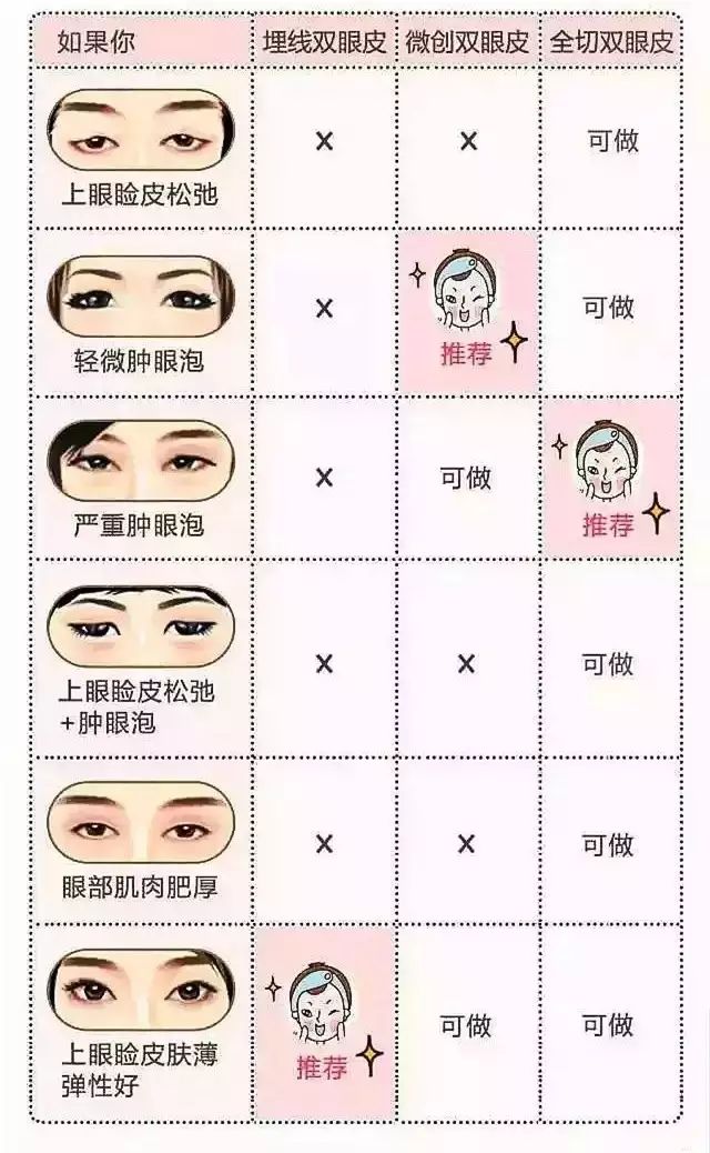 tips:  切开法适合于任何类型任何年龄的单眼皮者,而且是上眼皮皮肤