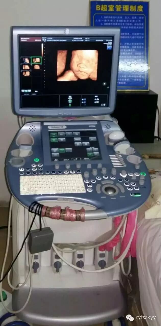 原来怀孕不做四维彩超会这么后悔(中医特色专科医院健康科普节目二)-怀孕期