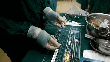 20张gif图全解脑深部电刺激手术过程(dbs,脑起搏器手术)