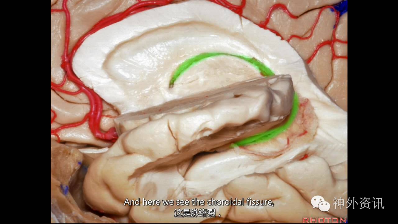 《navigating the ventricles》大脑与幕上脑室 the rhoton