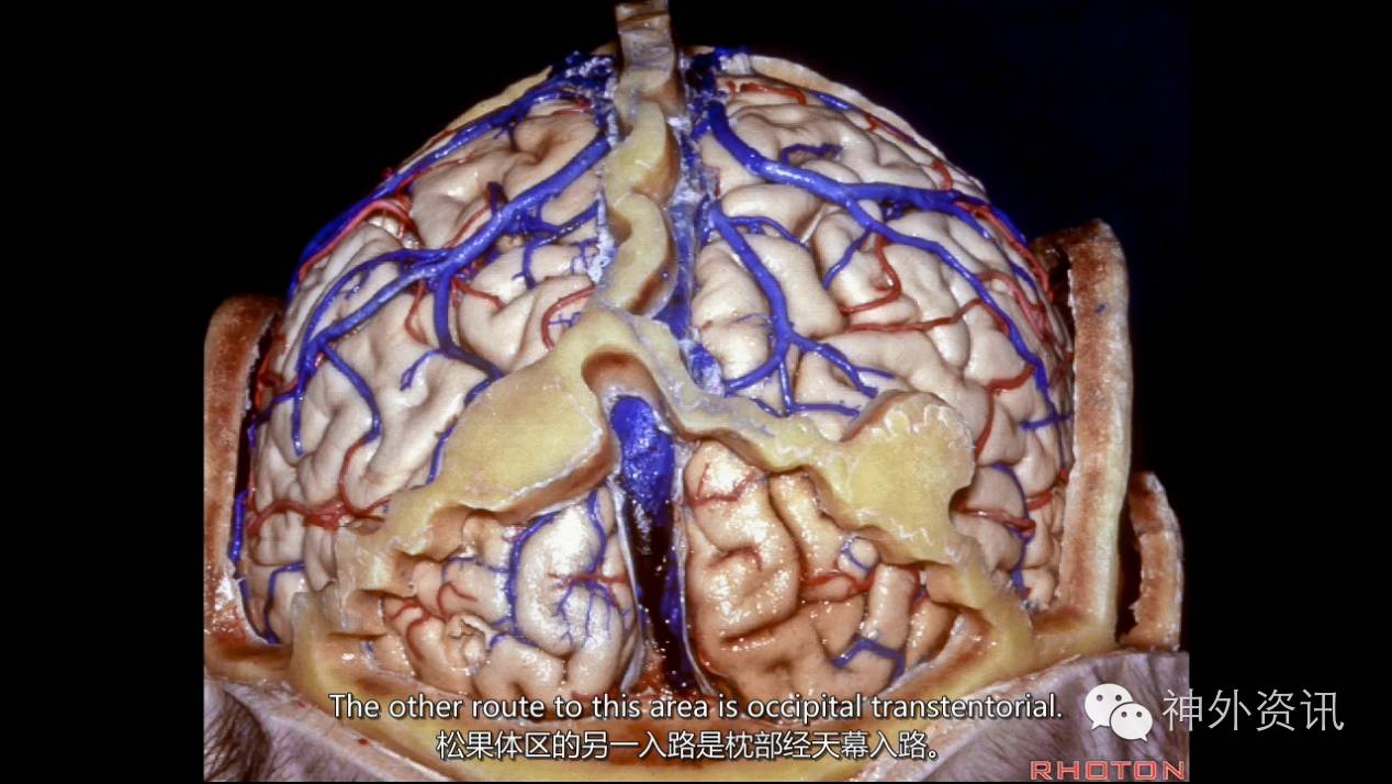 《navigating the ventricles》大脑与幕上脑室 the rhoton