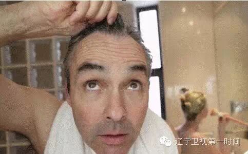 【防止脱发】防脱发要趁早！早看早受益！