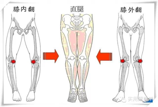 膝盖外翻或内翻不仅影响膝盖关节本身,也对支持它的肌肉造成影响.