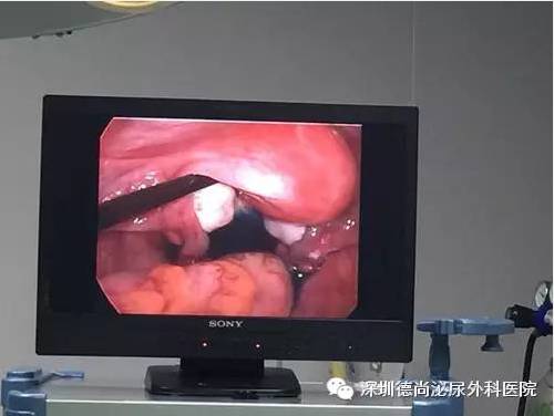 |暖新闻|千里传音报喜讯,结婚了,怀孕了,真心感激吴主任-怀孕期