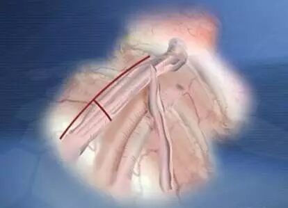 请相信美容院的经络疏通