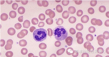 1,正常外周血涂片:红细胞,中性粒细胞,血小板