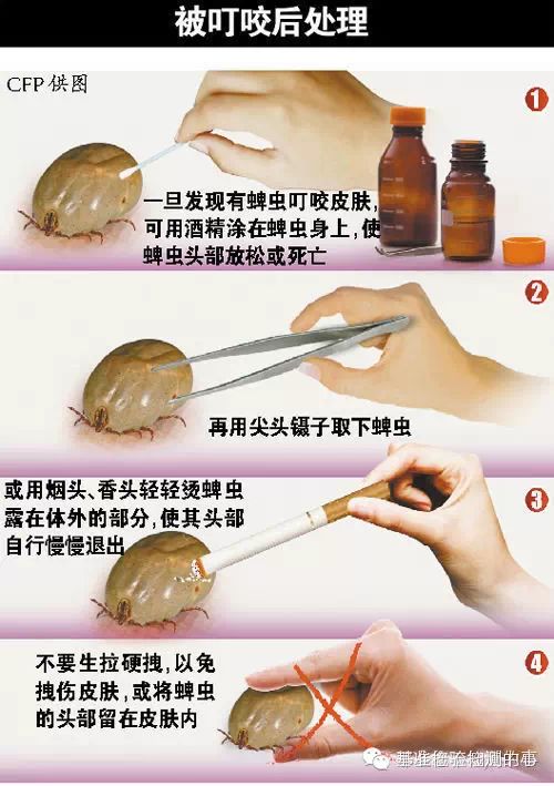 蜱虫的个人保护和处理