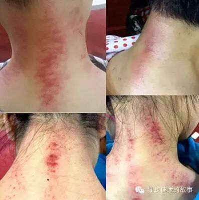 书香节，「聪明人傻瓜艾灸法」亲体验