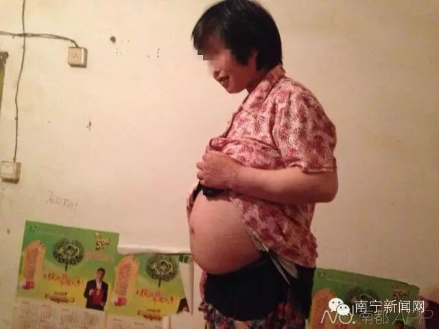【可怜】精神病人在敬老院内怀孕 或被利用食物诱奸所致-怀孕期