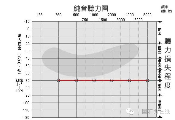 听力小百科：您会看听力图吗？