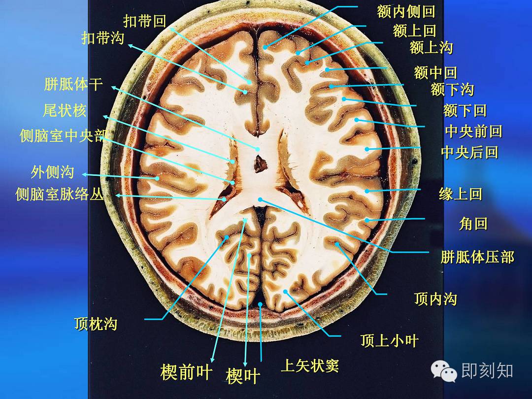 【大脑揭秘】颅脑ct横断层解剖
