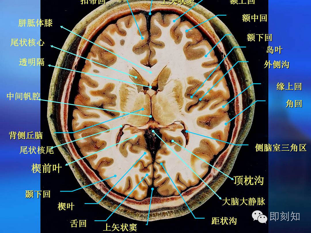 【大脑揭秘】颅脑ct横断层解剖