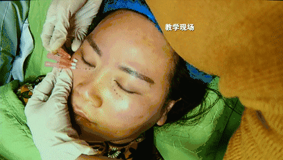 ▲张女士提供的一段微整形培训班教学现场的画面