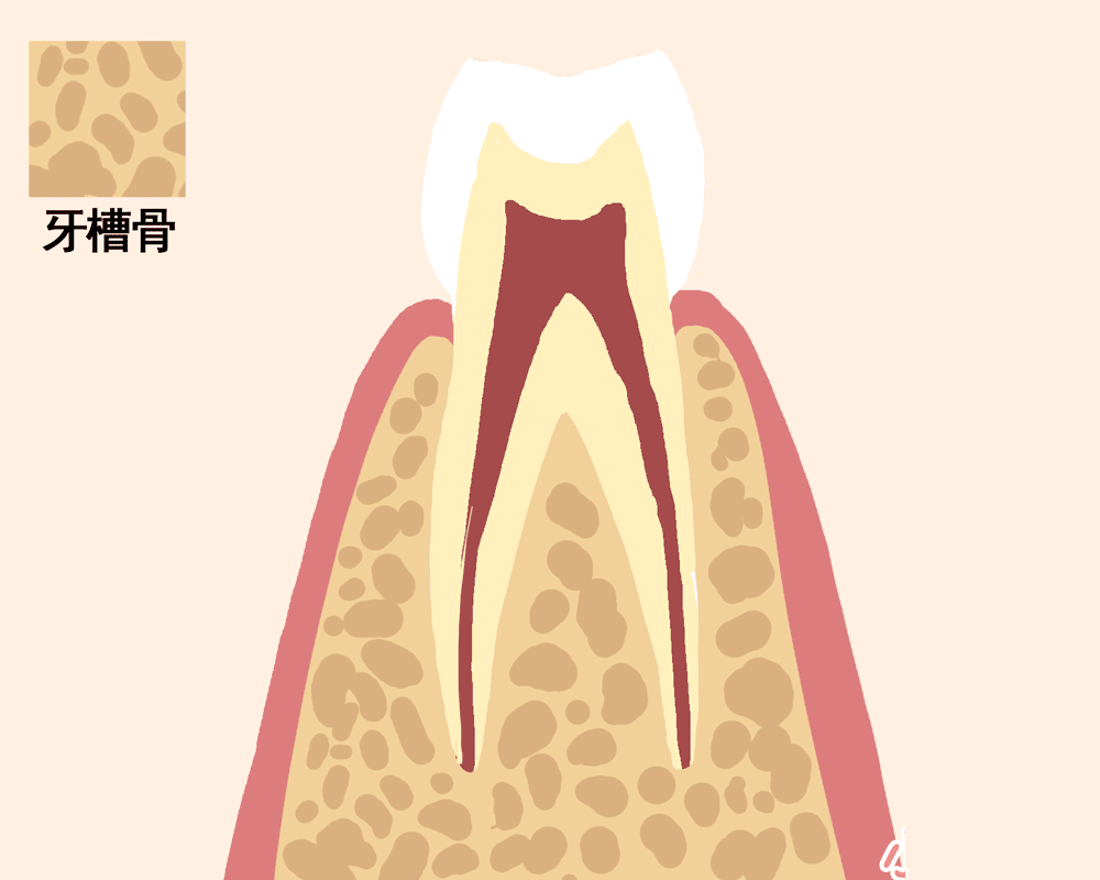 一张动图告诉你，牙齿走向脱落的过程……