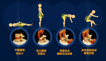 如果不尽早采用,腰椎就出问题,下一步就容易攀岩腰间盘突出.出现v腰椎干预图片
