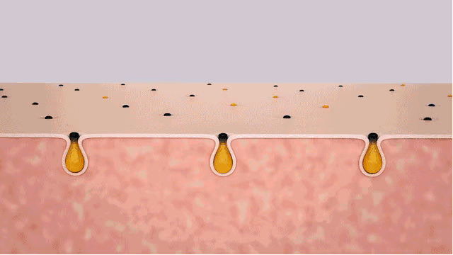 还在挤黑头让你亲眼目睹黑头连根拔起的可视化黑头仪太酸爽