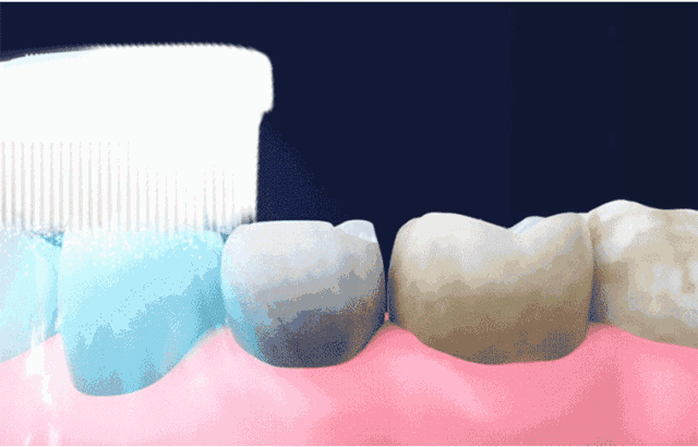 怎么选洁牙器械【诺美口腔·4店适用】49.9元享洁牙套餐：口腔健康档案、全口口腔问题诊断、无菌治疗器械、成人超声波洁牙...._https://www.jmylbn.com_新闻资讯_第3张