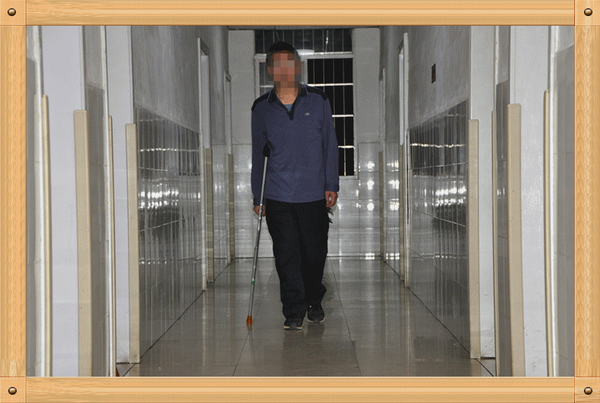 单拐行走:扶双拐行走一段时间后,患肢承载力度明显增强,行走步态